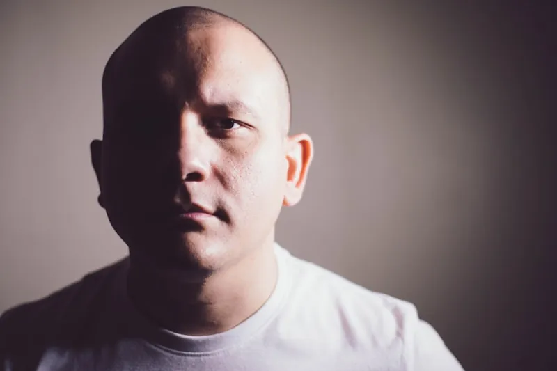 Hormonal hair loss treatment in Lahore: portrait of a man with a shaved head