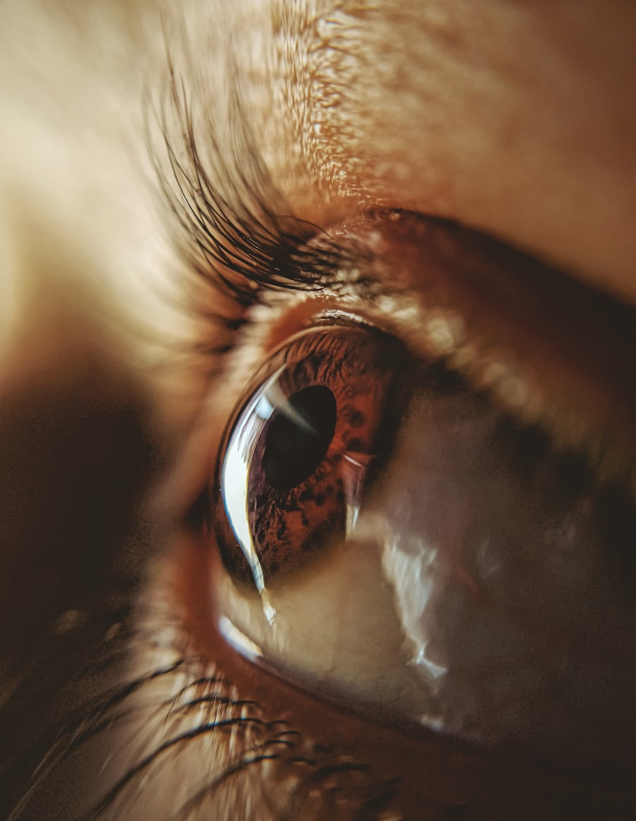 Graves' Eye Disease care at DHA Lahore