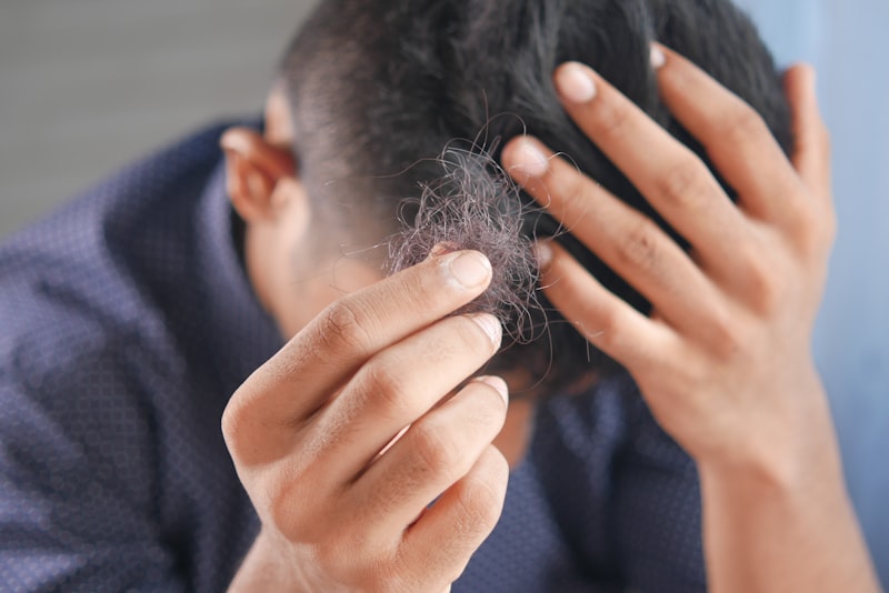 Male Hair Loss care at DHA Lahore