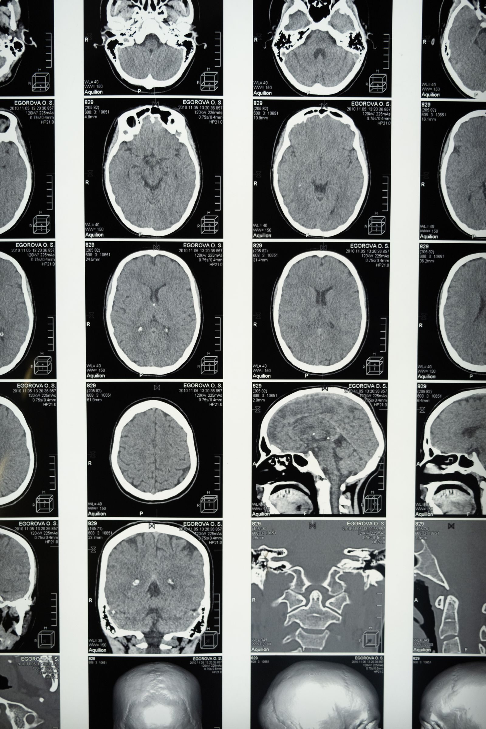 Pituitary gland hormone evaluation specialist DHA Lahore